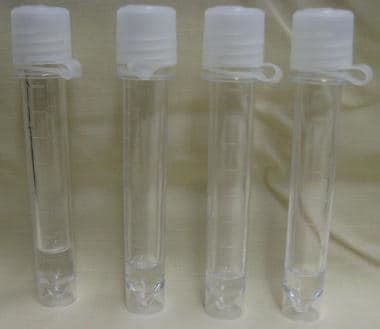 specimen bottle for spinal fluid test|Cerebrospinal Fluid Analysis: Reference Range, .